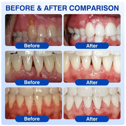 Aurethix® 🦷GumRevive Periodontal Care Gel🍀