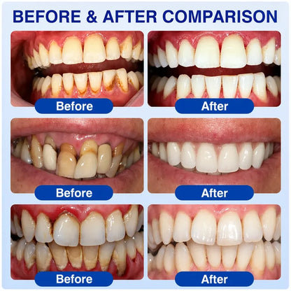Aurethix® 🦷GumRevive Periodontal Care Gel🍀