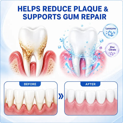 Aurethix® 🦷GumRevive Periodontal Care Gel🍀