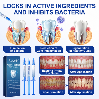 🇬🇧Aurethix® 🦷GumRevive periodontal repair gel💎💎💎
